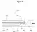 Fig. 32 - DEVICES AND METHODS FOR LIGATING ANATOMICAL STRUCTURES