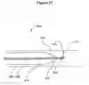 Fig. 33 - DEVICES AND METHODS FOR LIGATING ANATOMICAL STRUCTURES