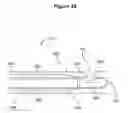 Fig. 34 - DEVICES AND METHODS FOR LIGATING ANATOMICAL STRUCTURES