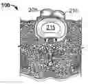 Fig. 01 - DEVICES AND METHODS FOR THE PRESERVATION OF SPINAL PROSTHESIS FUNCTION
