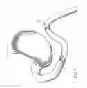 Fig. 02 - Positioning device for deploying at least one locking portion of an anastomotic device and method for carrying out anastomosis in tracts of the digestive tube