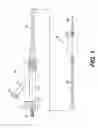 Fig. 02 - Dilation balloon having a valved opening and related catheters and methods