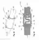 Fig. 18 - Dynamic fixation system