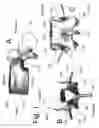 Fig. 02 - Device and method for the prevention of multi-level vertebral extension