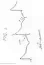 Fig. 02 - Methods for Determining a Vulnerable Window for the Induction of Fibrillation