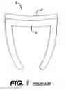 Fig. 02 - Concave resurfacing prosthesis