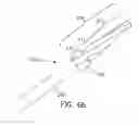 Fig. 09 - System and Method for Joint Resurface Repair