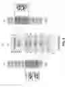 Fig. 06 - Techniques for shuffling video information