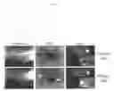 Fig. 02 - Methods for inhibition of angiogenesis and vasculogenesis via rspondin antagonists