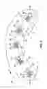 Fig. 06 - RELEASEABLE ONE-WAY CLUTCH