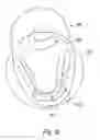 Fig. 07 - Panoramic dental radiology apparatus and associated method of use