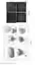 Fig. 14 - Methods for identifying stem cells by detecting fluorescence of cells and syncytia