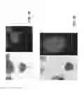 Fig. 23 - Methods for identifying stem cells by detecting fluorescence of cells and syncytia