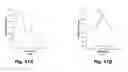 Fig. 18 - Lung cancer detection by optical analysis of body fluids