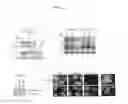 Fig. 03 - Inhibition of Skp2-cyclin a interaction