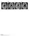 Fig. 12 - Sequence of dsRNA: ATN-RNA specific for tenascin-C
