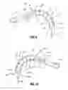 Fig. 09 - Handle assembly for articulated endoscopic instruments