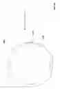 Fig. 35 - Rotate-to-advance catheterization system
