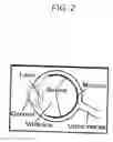Fig. 03 - Soft tip cannula and methods for use thereof