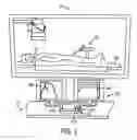 Fig. 02 - Catheter system