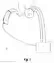 Fig. 02 - System and method for the objective measurement of hearing ability of an individual