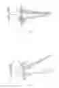 Fig. 02 - Speculum