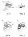 Fig. 03 - IONTOPHORETIC DEVICE