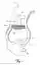 Fig. 02 - SURGICAL TOOL FOR VASCULAR EXPOSURE AND ACCESS