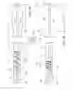 Fig. 02 - Biasing a catheter balloon