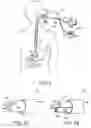 Fig. 02 - RIGIDIZABLE SURGICAL INSTRUMENT