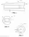 Fig. 02 - Method and Device for Stabilizing Joints With Limited Axial Movement