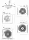Fig. 08 - Light adjustable multifocal lenses