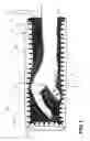 Fig. 02 - Immobilizing device for a part of a body