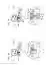 Fig. 08 - Sinus lift implant
