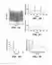 Fig. 07 - System and method for inferring disease similarity by shape matching of ECG time series
