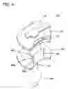 Fig. 07 - Medical device having prefilled balloon