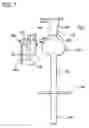 Fig. 08 - Medical device having prefilled balloon