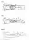 Fig. 03 - Collection catheter and kit