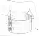 Fig. 01 - POST-OPERATIVE GARMENTS AND METHODS FOR CONTROLLING POST-OPERATIVE LEAKAGE