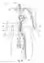 Fig. 02 - Guidewire replacement device