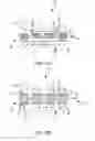 Fig. 02 - IMPLANTABLE FISTULA CLOSURE DEVICE