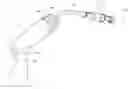 Fig. 01 - Delivery system for vascular implant