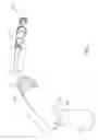 Fig. 02 - Delivery system for vascular implant