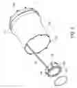 Fig. 09 - Delivery system for vascular implant