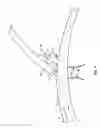 Fig. 02 - Vascular stenting and other procedures