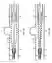Fig. 43 - Vascular stenting and other procedures