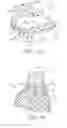 Fig. 02 - Computer-aided implanting of orthodontic anchorage devices using surgical guides