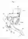 Fig. 02 - Accelerator pedal device