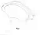 Fig. 02 - Friction material for brakes