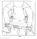 Fig. 04 - Method and apparatus for securing a child